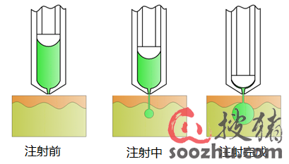 獸用無(wú)針注射器 現(xiàn)代化獸醫(yī)醫(yī)療器械的創(chuàng)新與優(yōu)勢(shì)